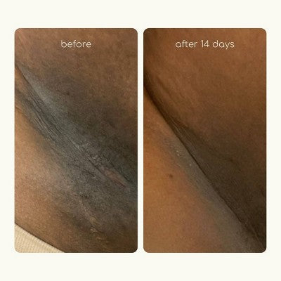 Forgotten Skincare Underarm Brightening Deodorant Cream